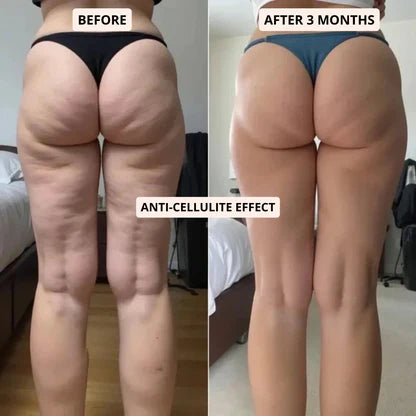 Fitava 3D Anti-Cellulite Leggings